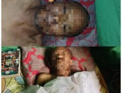 Warga Perbaungan Heboh, Pria 47 Tahun Ditemukan Meninggal di Pajak Baru