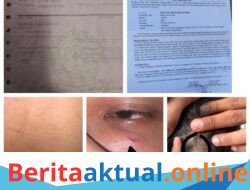 Remaja di Tambun Selatan Diduga Dikeroyok, Keluarga Tempuh Jalur Hukum