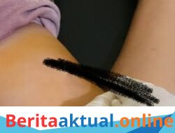 Warga Kritis Mengeluarkan Cairan Di Telinga Diduga Gegara Pemasangan KB, Implan Gagal